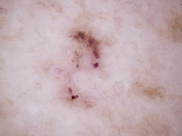BCC5