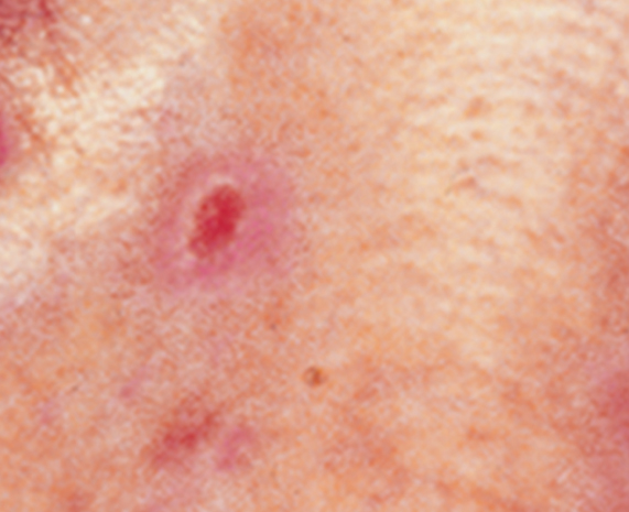 BCC_PinkGrowth-1