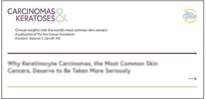 Carcinomas and keratoses banner preview