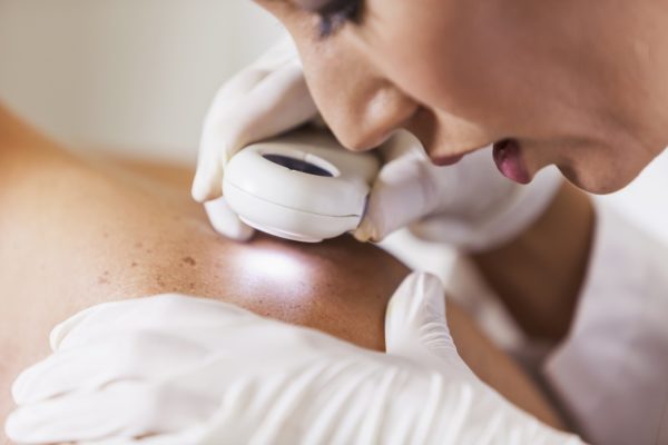 Skin Exam SCF skin exam