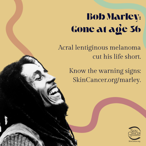 Bob Marley passed away at the age of 36.